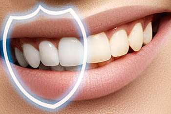 Новости стоматологии: восстановление зубов